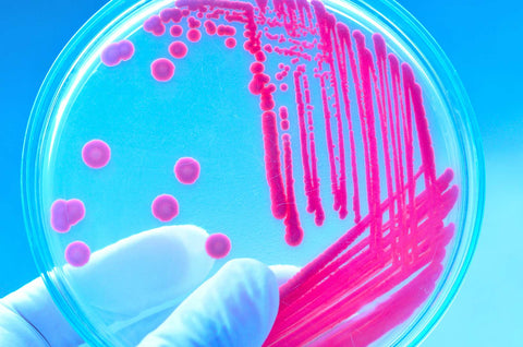 What’s the Difference Between Resident and Transient Strains?